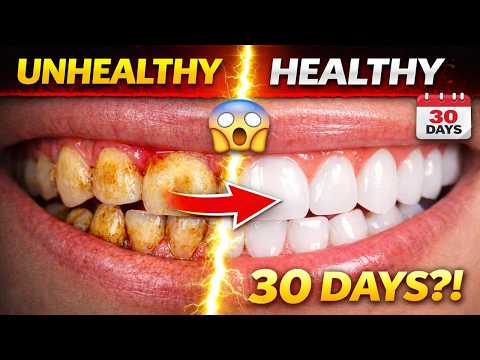 🦷 How I Fixed My Teeth Health in 30 Days (Real Routine)