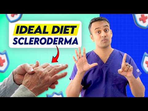 **BEST**  Diet for Scleroderma (ANA+): Top 4 Triggers, Food to Avoid (PhytoDiet by Dasari MD)