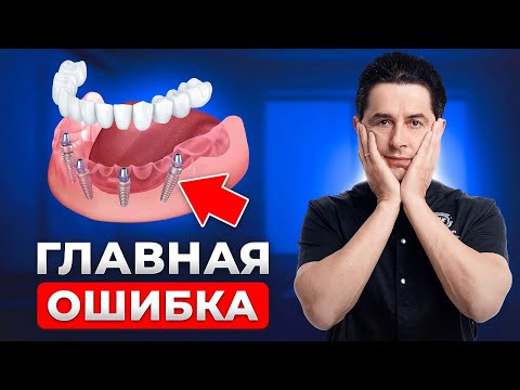 Вся правда про имплантацию ВСЕ-НА-4. Как не остаться без зубов