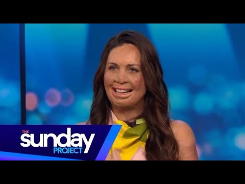 Turia Pitt: Why I Love Running So Much