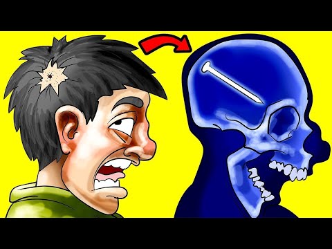 Везунчики, Которые Пережили Невероятное. Часть 8