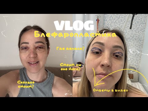 Мой честный опыт блефаропластики / я сделала операцию и вот что из этого вышло 