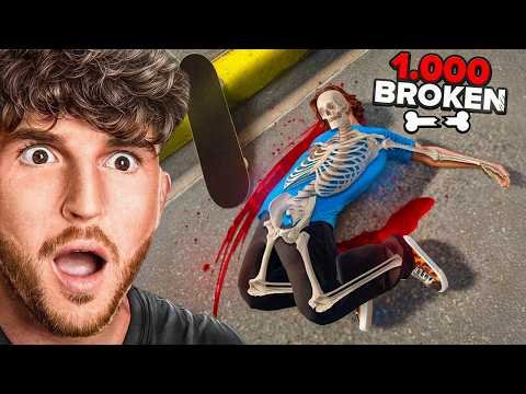 Breaking ALL 1000 BONES As a PRO SKATEBOARDER!