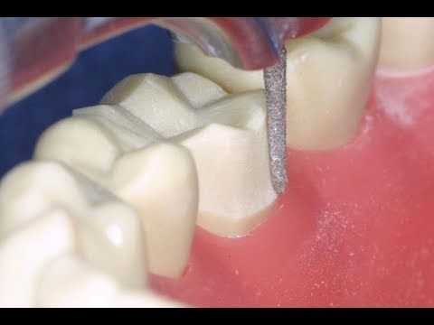 Full Gold Crown in 7 Steps | Technique for Preparing the FGC on A Mandibular Molar