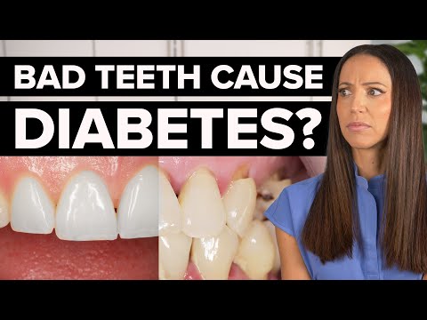 The Hidden Link Between Diabetes and Your Teeth
