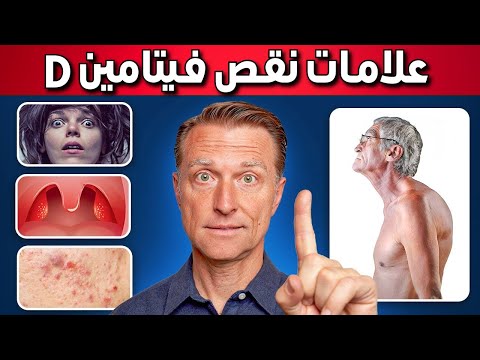 أعراض غريبة بسبب نقص فيتامين د لم تسمع بها من قبل