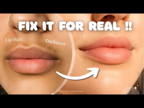 How to get rid of DARKNESS around the mouth 🍒 + Upper lip hair REMOVAL METHODS 🌸