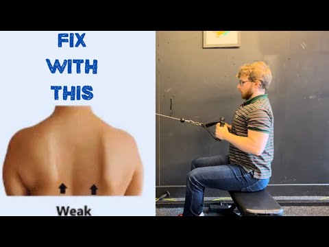 5 Exercises That Fix Scapular Winging | Complete Guide and Workout Plan 💪✅
