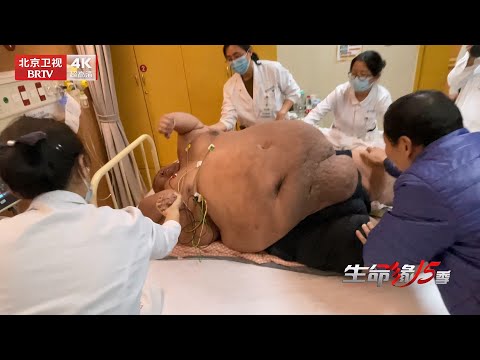 2025最新|中国第一胖，718斤小伙自称濒死求助入院，当见到本人，医生还是震惊了【生命缘第15季】
