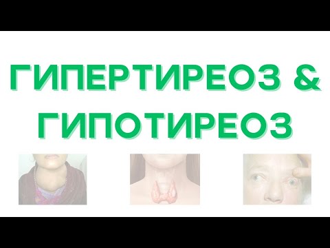 Қалқанша безінің патофизиологиясы - ГИПЕРТИРЕОЗ, ГИПОТИРЕОЗ