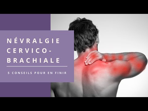 Say Goodbye to Cervical Neuralgia: 5 Tips (You Don't Already Know)