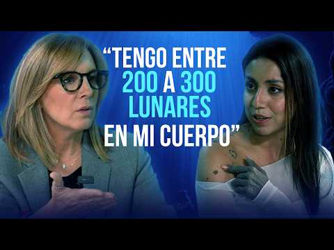 ‘Me sugirieron amputar el brazo por un lunar y solo me dieron tres años de vida’:  Libny Molano