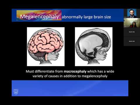 Malformations of Cortical Development -- Dr. Julie Guerin --12/12/2024