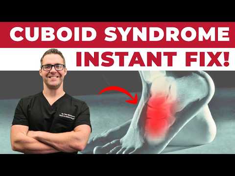 Cuboid Syndrome Treatment [FIX Lateral Outside of the Foot Pain]