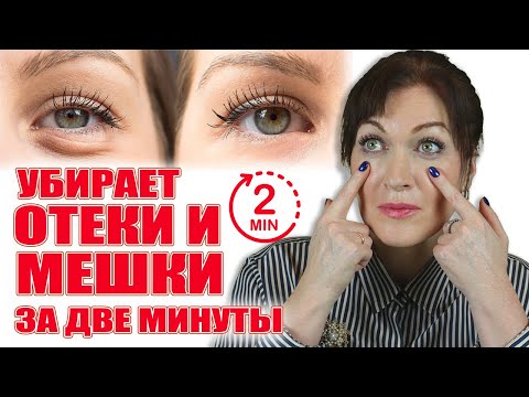 Отеки мешки под глазами? В видео решение проблемы!