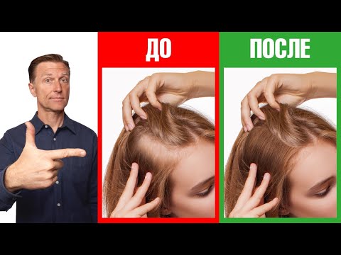 Как сделать волосы гуще? Простые советы👌