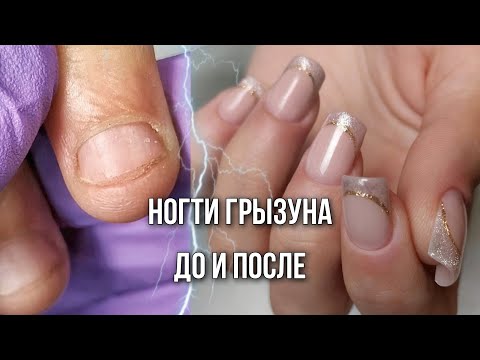 Eaten nails. Extensions on complex hands. Rodent nails.