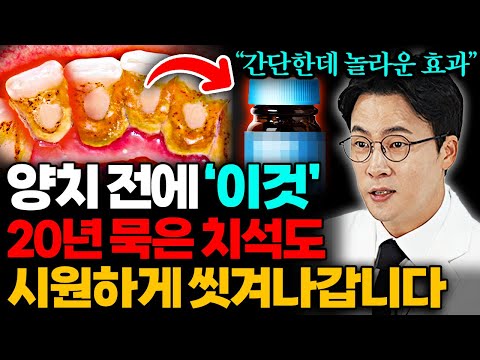 25년 치과의사의 영업비밀. 40대 이후 치석, 잇몸병 싹 없애는 최고의 방법 (장혁진 원장 통합본)