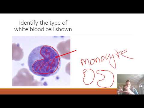 AP II Practice Lab Exam 1: Blood & Heart
