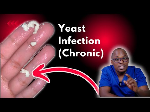 Chronic Yeast Infections | Recurrent yeast Infections - Causes, signs and symptoms Treatment