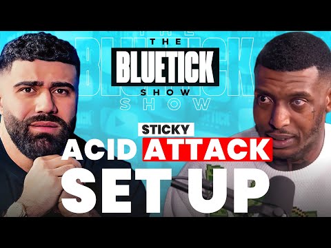 WHY THEY ACID ATTACKED ME!! (UNTOLD STORY)  Ep171