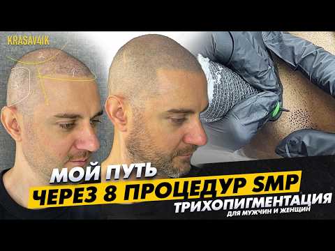 My TRICHOPIGMENTATION (SMP): Everything You Wanted to Know (4 Years of Research in One Video) KRA...
