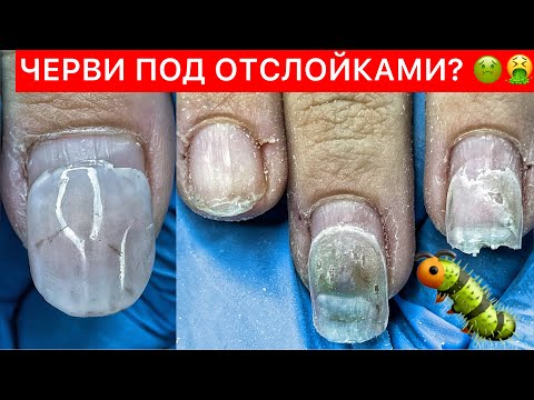 ЖЕСТЬ ЧТО С НОГТЯМИ🤢🤮УЖАСНАЯ РАБОТА ОТ ДРУГОГО МАСТЕРА🤬Бренд Pur Pur Professional 🥰