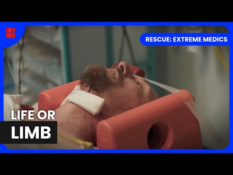Chainsaw Accident: Emergency Response | Rescue: Extreme Medics