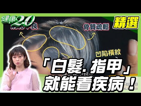 身體好不好「白髮、指甲」就能看疾病！改善白髮這樣做【@tvbshealth20 精選】