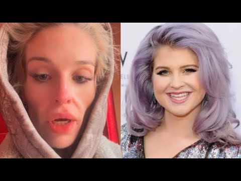 Before & After Photos Of Kelly Osbourne's Ozempic Face Have Fans WORRIED