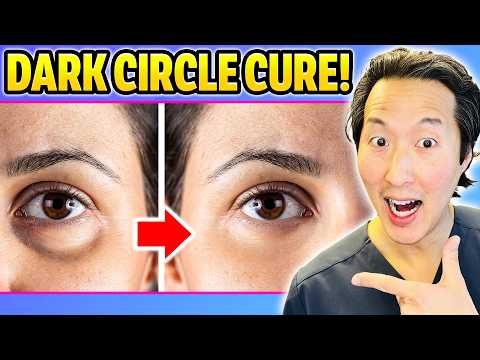 Plastic Surgeon: How to Get Rid of Dark Circles of Undereyes!