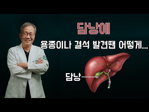 담낭에 용종이나 결석 발견땐? 쓸개 제거해도 사는데 지장없나
