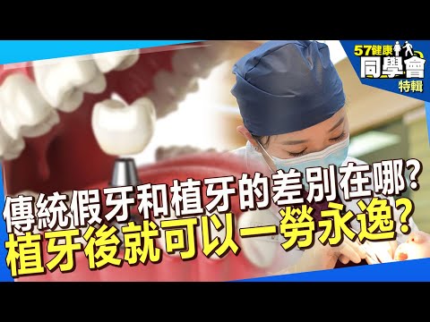 【精選】傳統假牙和植牙的差別在哪？植牙後就可以一勞永逸？ @57healthy