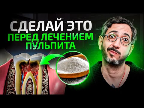 НЕ начинай лечить ПУЛЬПИТ, пока не посмотришь это видео!