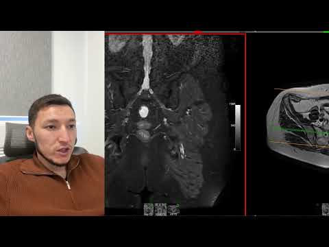 МРТ анатомия органов малого таза у женщин