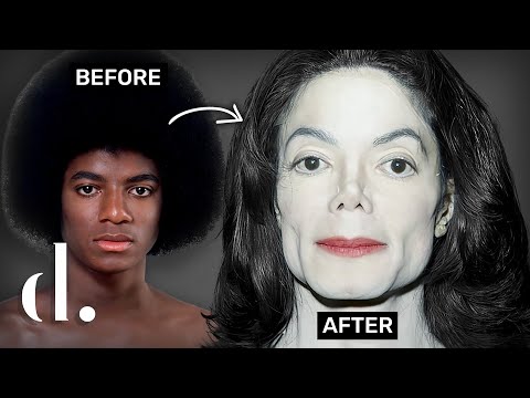 How Much Plastic Surgery Did Michael Jackson Actually Have?!! NEW DETAILS | the detail.