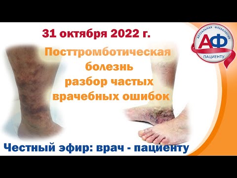 Посттромботическая болезнь = что происходит после тромбоза глубоких вен