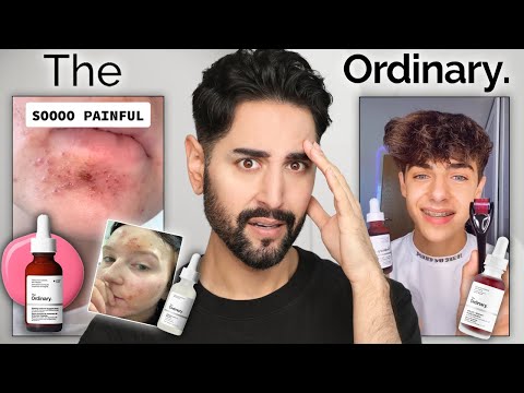 Are The Ordinary's Products Actually Dangerous? The Truth About The Chemical Burn Claims