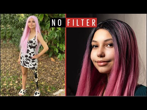 I Survived Shark Attack At Age 17 | No Filter | @ladbiblestories