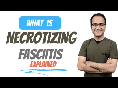 Necrotizing fasciitis Flesh Eating Bacteria Treatment, Dermatology Medicine Lectures, USMLE, NEETPG