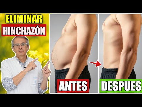 Cómo ALIVIAR la HINCHAZÓN Rápido 👉  Descubre las 5 CAUSAS