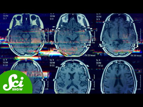 Menopause Starts Way Earlier Than You Think