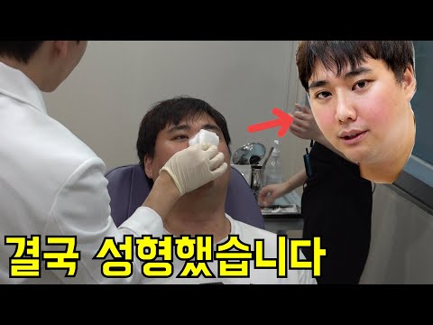 외모대결 져서 성형시술하게 된 건에 대하여