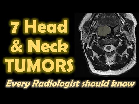 7 Head and Neck Tumors every Radiologist should know