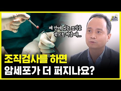 폐암 치료의 시작, 폐조직검사 어떻게 할까요? | 조직검사는 암을 전이시킬까? | 대한폐암학회