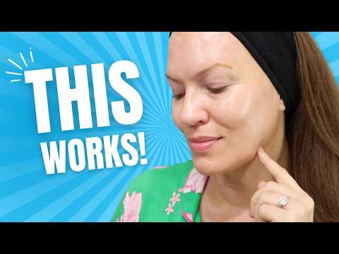 $8.85 HIDDEN GEM to fade DARK SPOTS, MELASMA & ACNE SPOTS! One of my FAVORITE "Anti-Aging" Serums