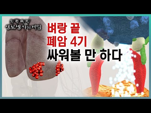 📌방송하이라이트📌흡연자의 암이라는 공식이 깨진 폐암의 원인과 치료법, 그리고 희망을 놓지 않은 사람들의 이야기 (KBS 20230719 방송)