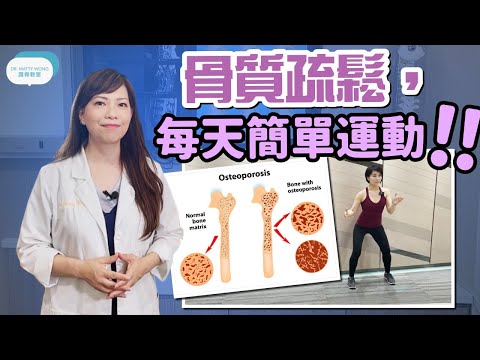 骨質疏鬆有什麼徵狀I 如何才能知道自己有骨質疏鬆症 I 毎天簡單伸展及強化運動 - 脊醫王鳳恩