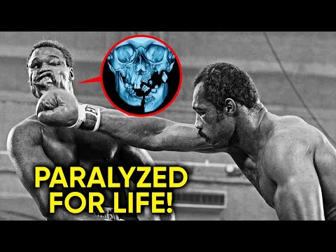 Scariest Injuries In Boxing History