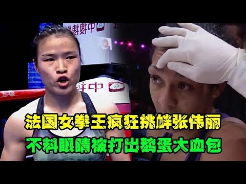 法国女拳王不服张伟丽，来华点名挑战，不料眼睛被打出鹅蛋血包！
